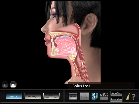 Screenshot #4 pour Oral Disorders