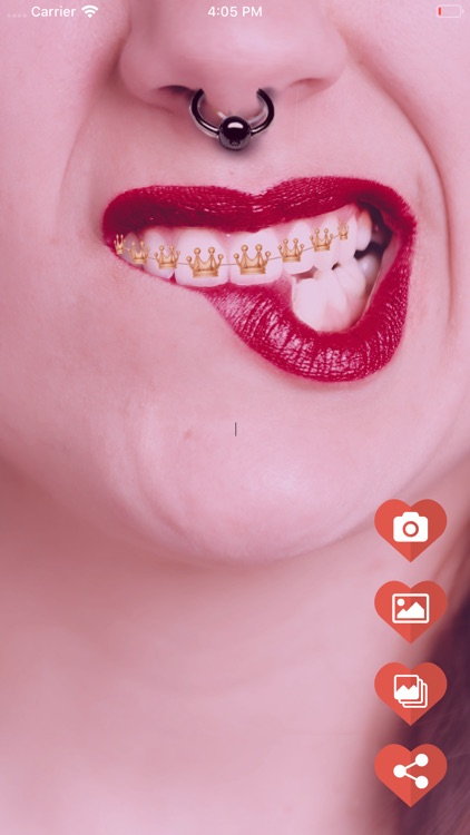 Piercing - Teeth Braces on Fac