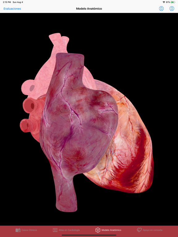 Screenshot #6 pour Update in Cardiology