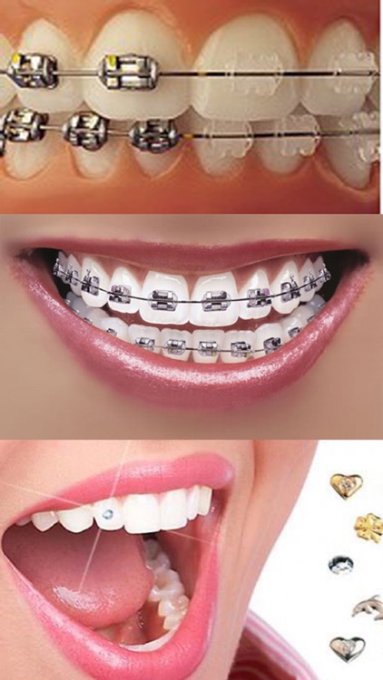 Orthodontic