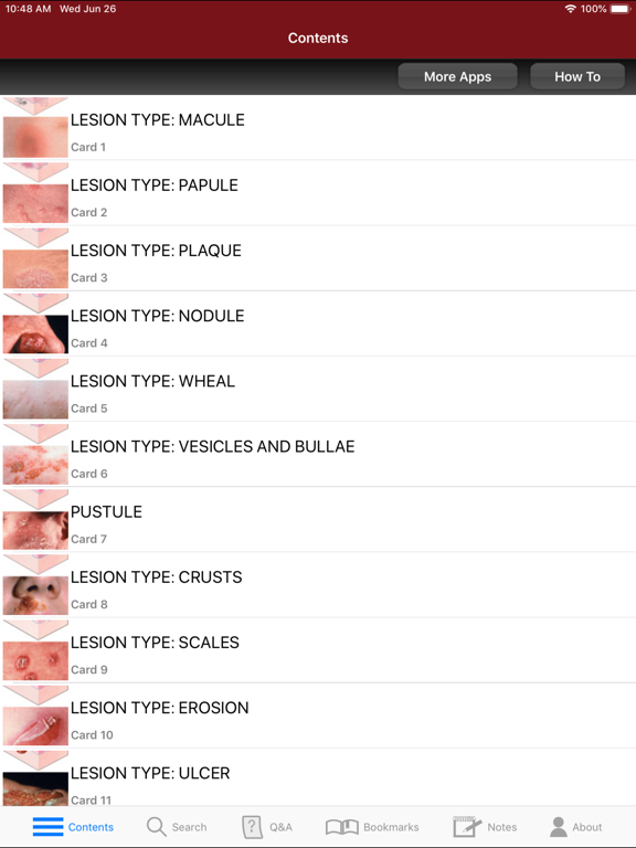 Screenshot #5 pour Fitzpatrick's Derm Flash Cards