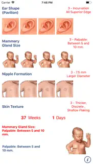 neonatology: test capurro iphone screenshot 4