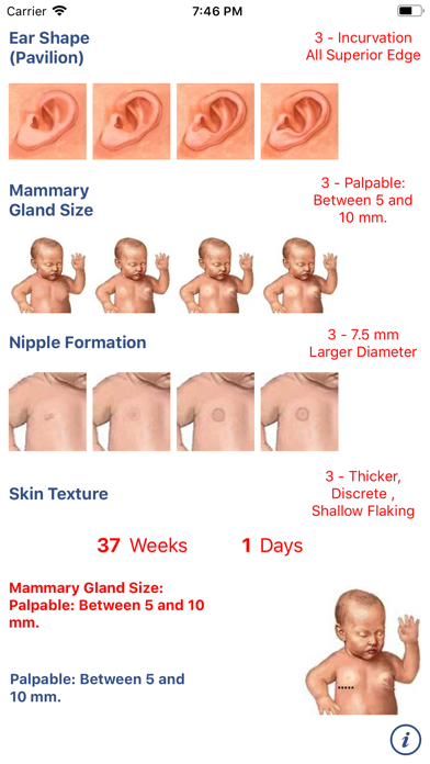 Neonatology: Test Capurro Screenshot