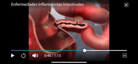 Fisiología & Patología