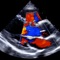 Unique to EchoLab among echocardiography applications is the powerful Analytic Engine, which synthesizes results from multiple calculations into a cohesive overview with a comprehensive summary, with integration of 2016 ASE/EACVI diastolic function guidelines, 2015 ASE/EACVI cardiac chamber quantification guidelines, and 2014 ACC/AHA guidelines for valvular heart disease