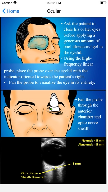 EMUltrasound screenshot-3