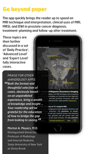 MR Imaging in Prostate Cancer screenshot 2