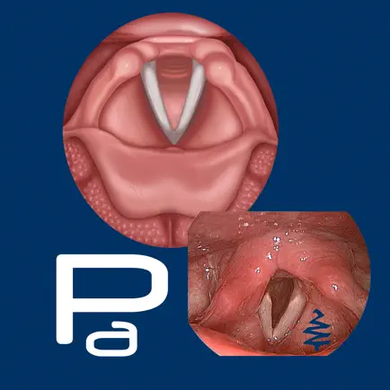 Paresis/Paralysis Читы