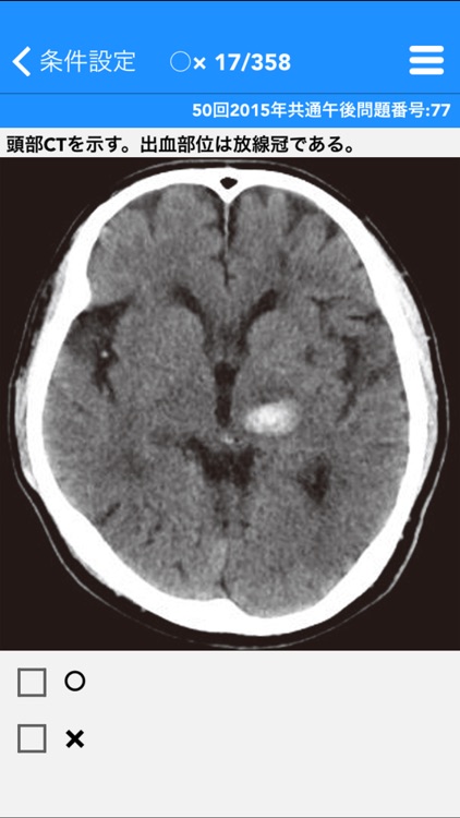 必勝カコもんPTOT共通（臨床医学）