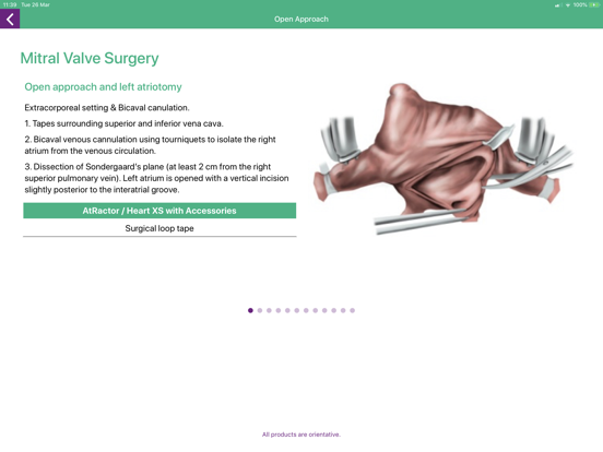 Screenshot #5 pour Cardiac Surgery Basics