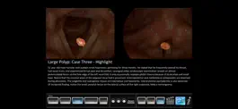 Game screenshot Vocal Pathology: Polyps hack
