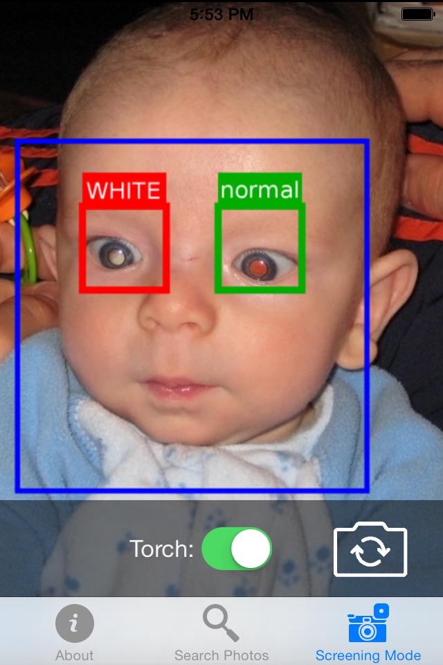 CRADLE White Eye Detector screenshot 2