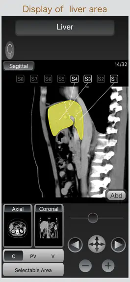 Game screenshot CT Passport Abdomen hack