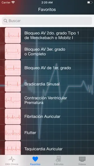 Captura de pantalla de EKG Clínico en iPhone 5
