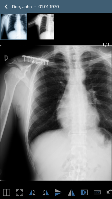 Screenshot #2 pour Issa PACS Client