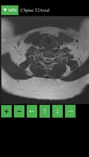 mri viewer iphone screenshot 4