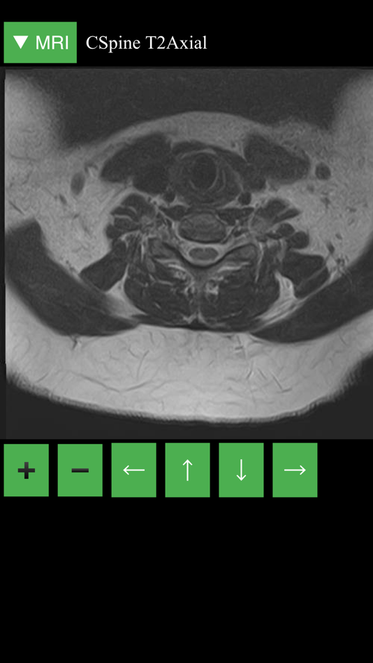 #4. MRI Viewer (iOS) 来自: Lieu Duong