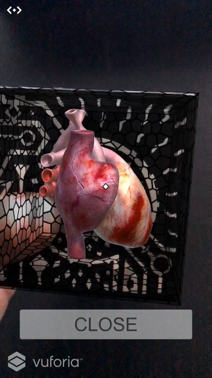 AR Medical