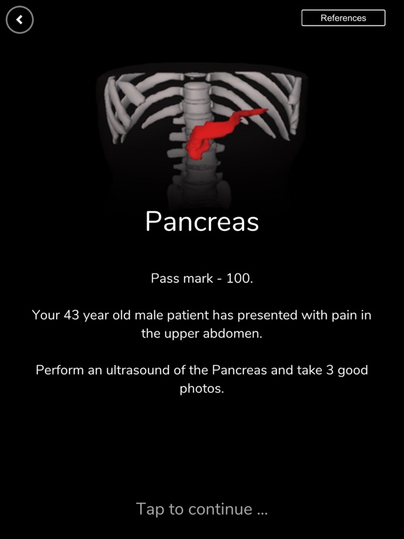 Screenshot #6 pour Deepscope Ultrasound Simulator