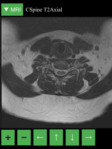 MRI Viewerのおすすめ画像4