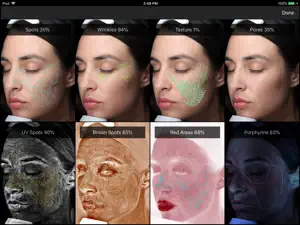VISIA® screenshot 4