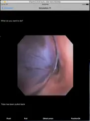 double lumen ipad resimleri 1