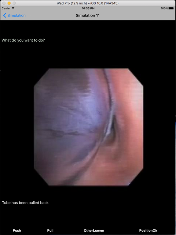 Screenshot #4 pour Double Lumen