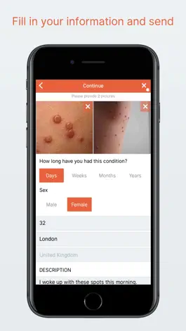 Game screenshot iDoc24 - Ask a dermatologist apk