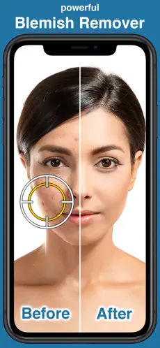 Screenshot 1 Blemish Remover Photo Tool iphone