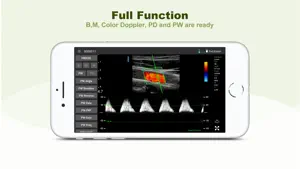 LELTEK Ultrasound - LeSono screenshot 2