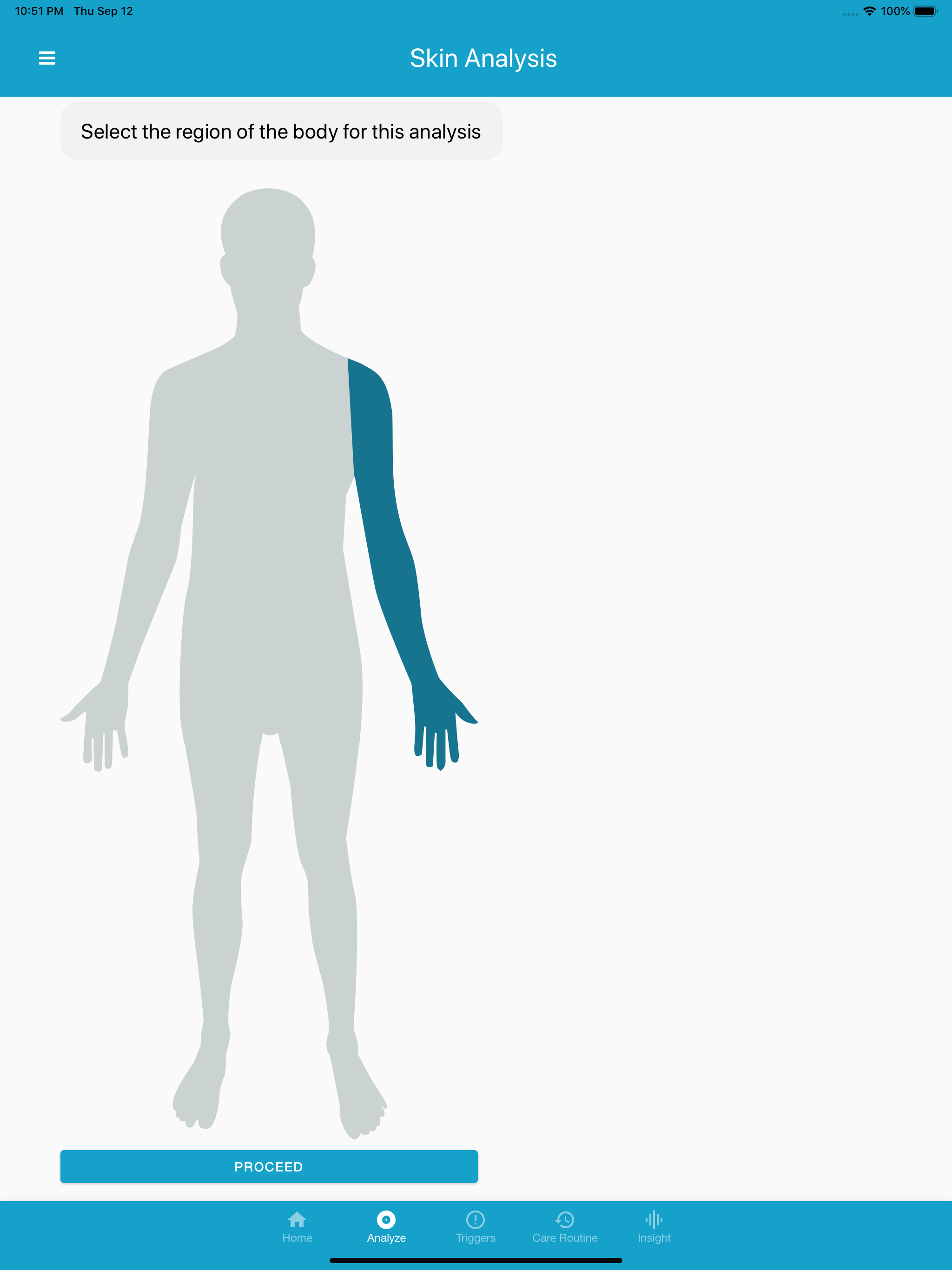 EczemaLess, an AI Eczema Guide