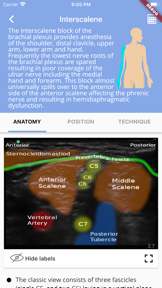 Regional Anesthesia Reference screenshot