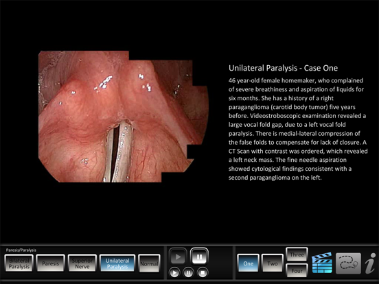 Screenshot #6 pour Paresis/Paralysis