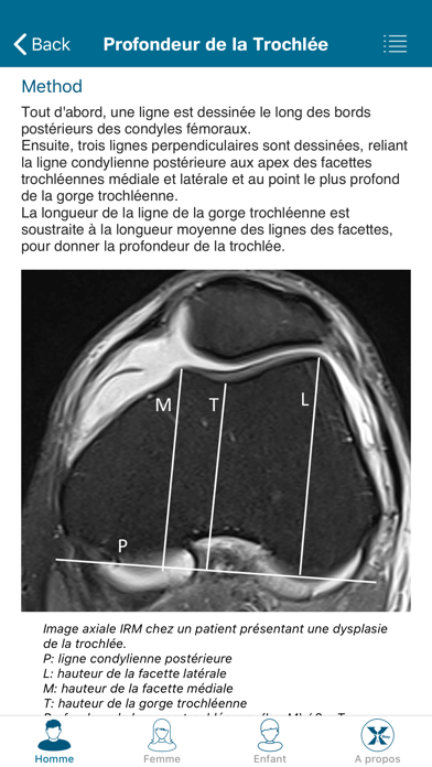 Screenshot #3 pour Radiology Measurements