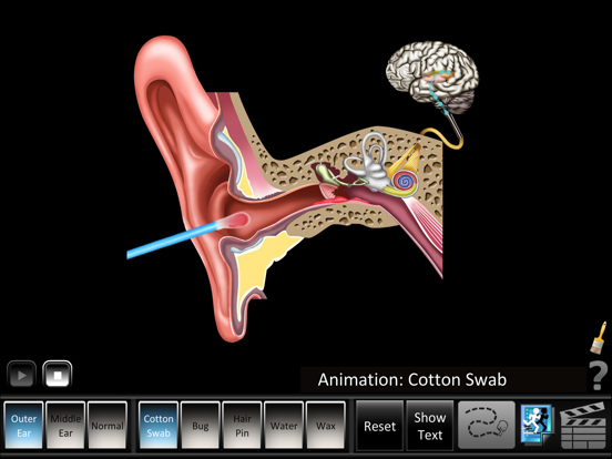 Screenshot #4 pour Ear Disorders: Outer Middle