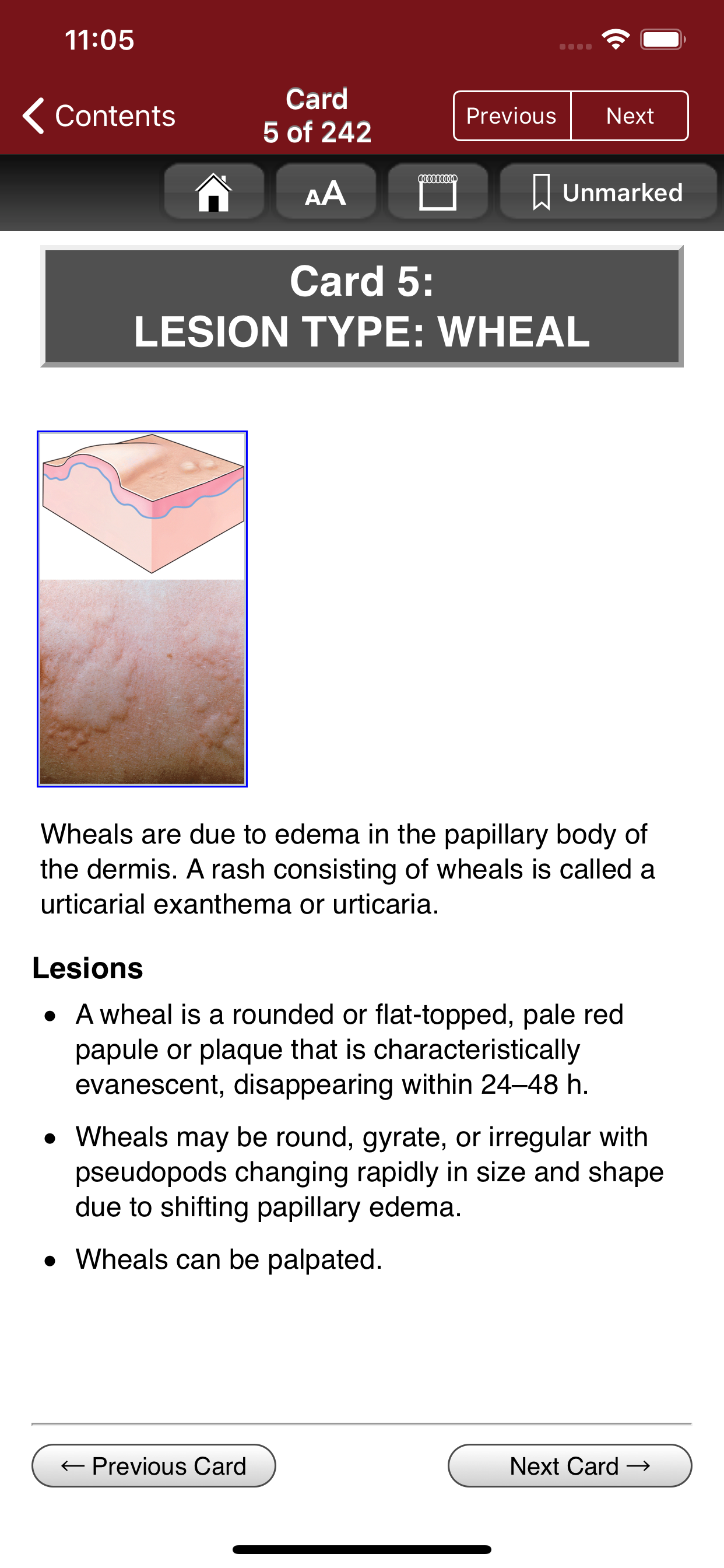 Fitzpatrick's Derm Flash Cards