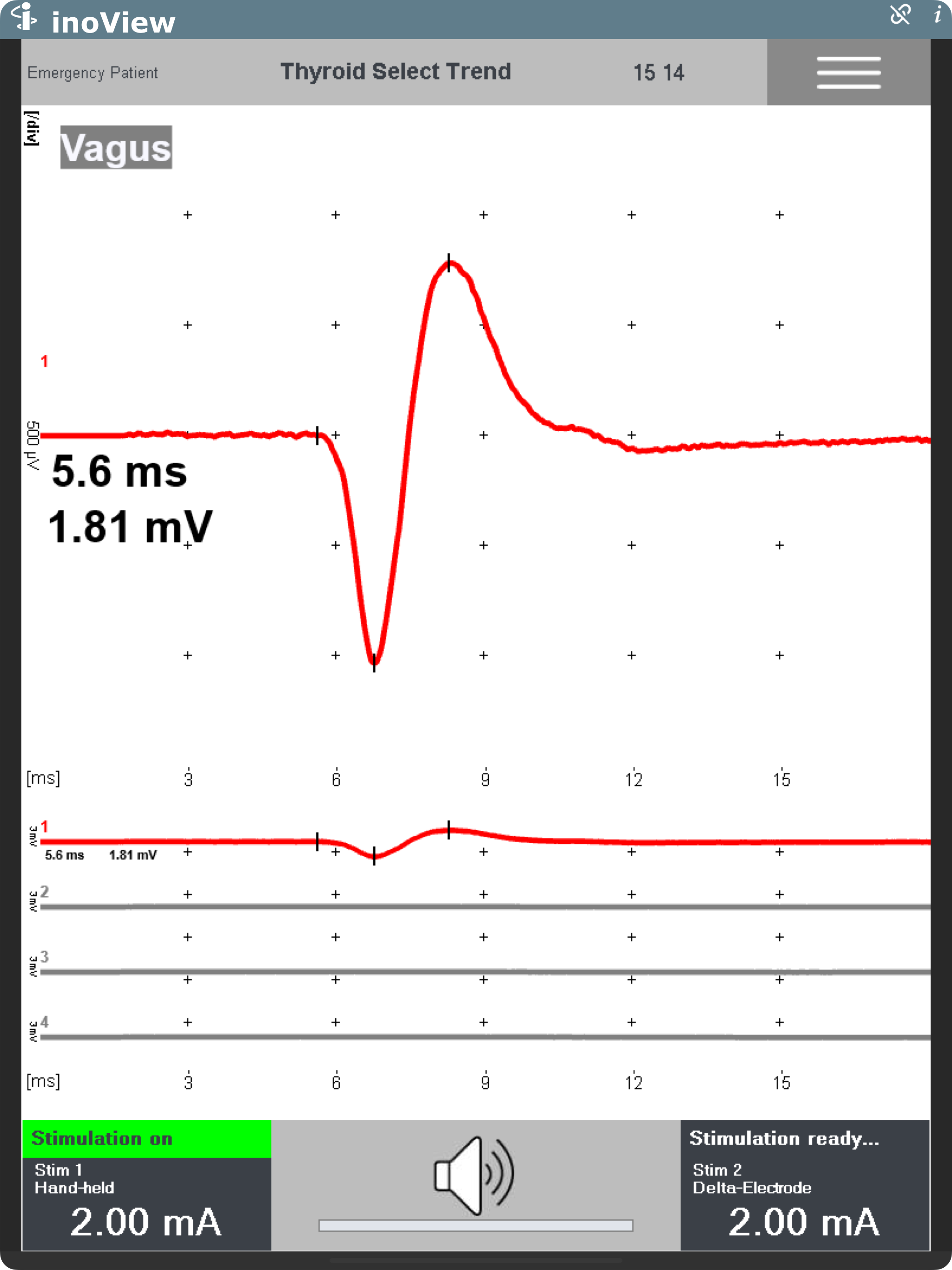 inoView screenshot 4