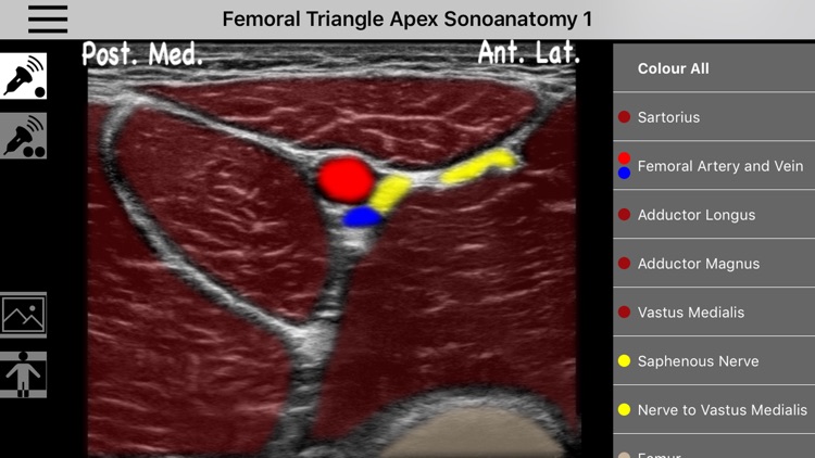 AnSo Anaesthesia Sonoanatomy screenshot-0