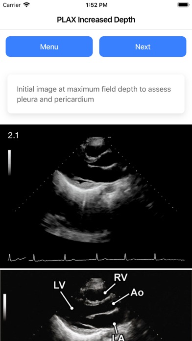 Cardio Guide screenshot 4