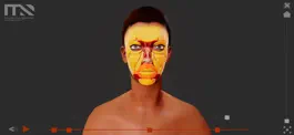 Game screenshot Facial Fat Grafting hack