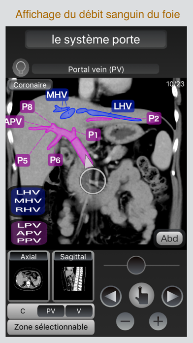 Screenshot #2 pour CT Passeport Abdomen