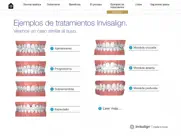invisalign pro consultation ipad capturas de pantalla 4