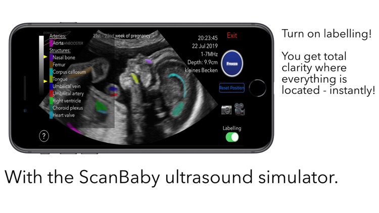 ScanBaby learn baby ultrasound screenshot-4