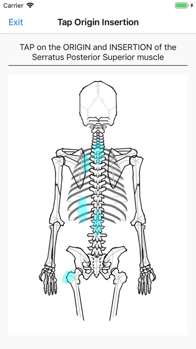 Screenshot #2 pour Simple Lines Anatomy