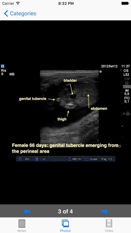 Advanced Equine Repro U/S screenshot-4