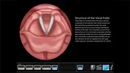 Game screenshot Vocal Pathology: Polyps mod apk