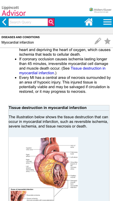 Lippincott Nursing Advisor Screenshot