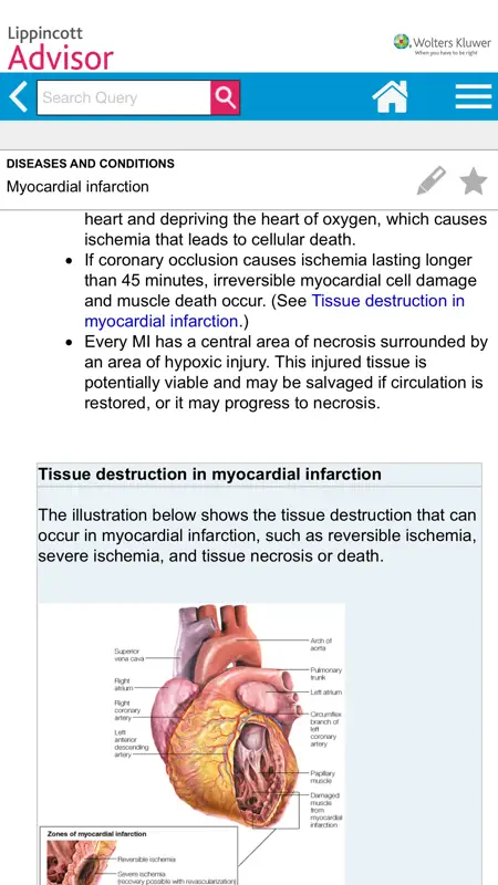 Lippincott Nursing Advisor screenshot 2 of 3