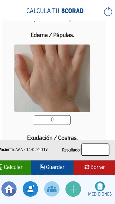 Calcula tu SCORAD screenshot 4