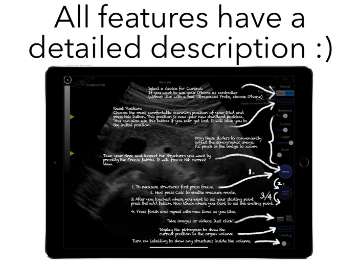 Scanbooster Ultrasound Sim